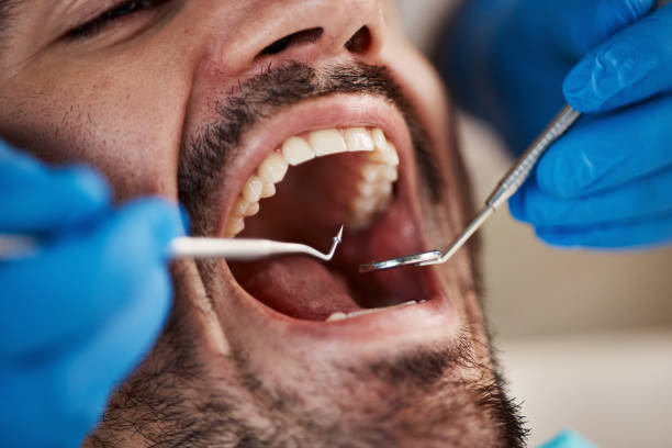 Laser Dentistry in Parkersburg, IA